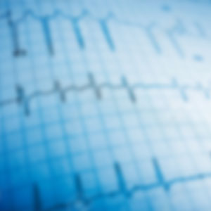 ekg